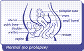 diagram of normal pelvic organ positions